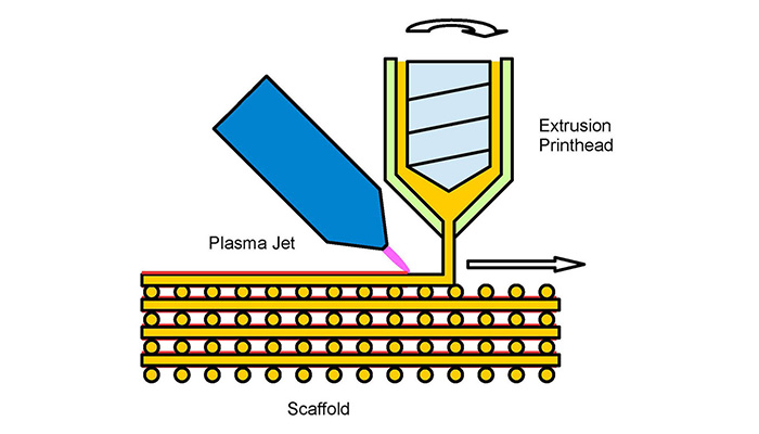Implantes óseos impresos en 3D con inyección de plasma